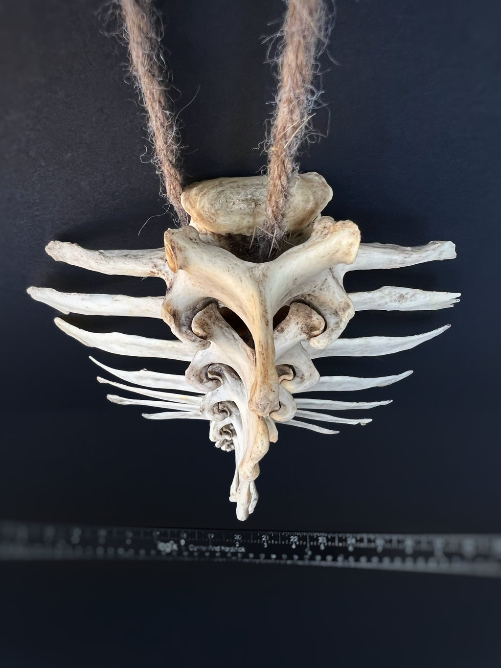 Thoracic Vertebrae & Rib Section – Natural Bone Specimen