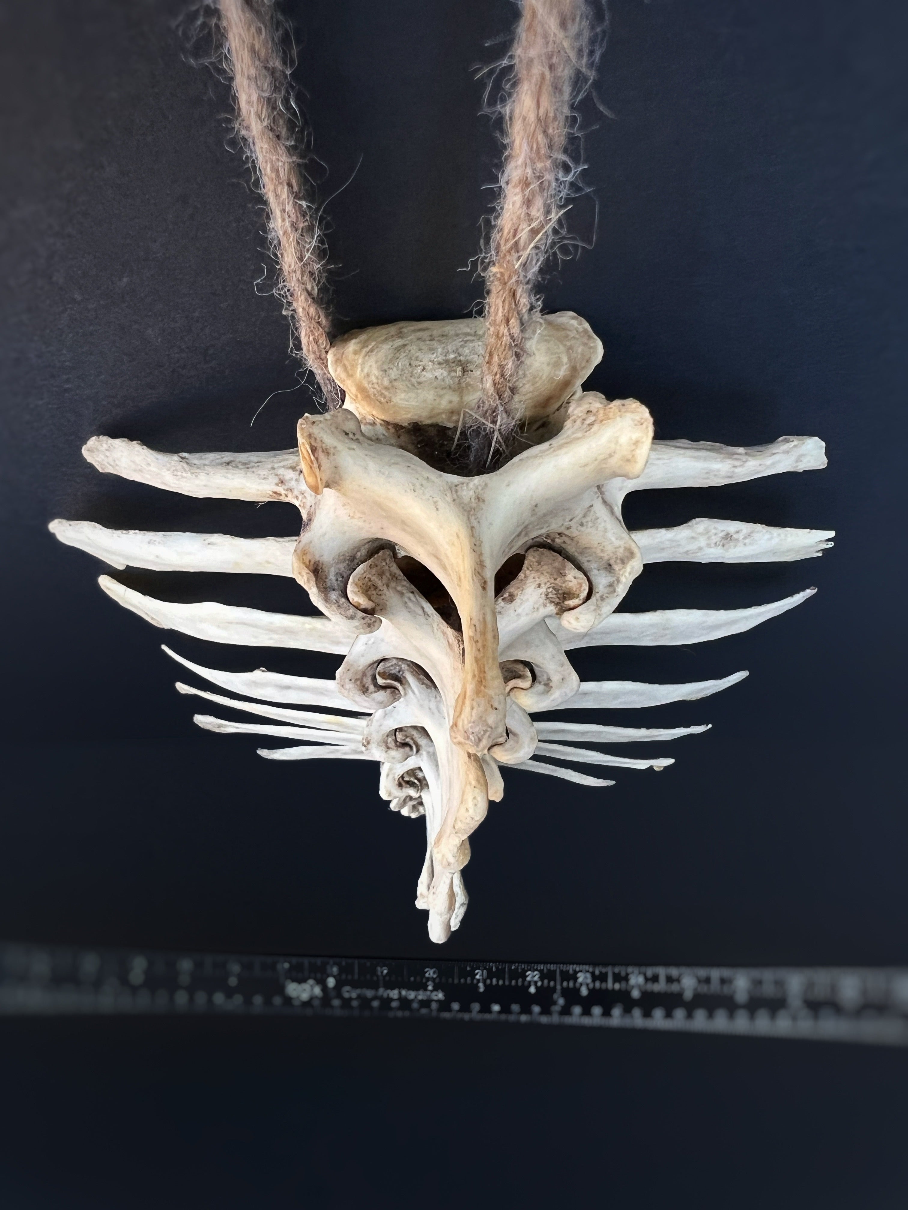 Thoracic Vertebrae & Rib Section – Natural Bone Specimen