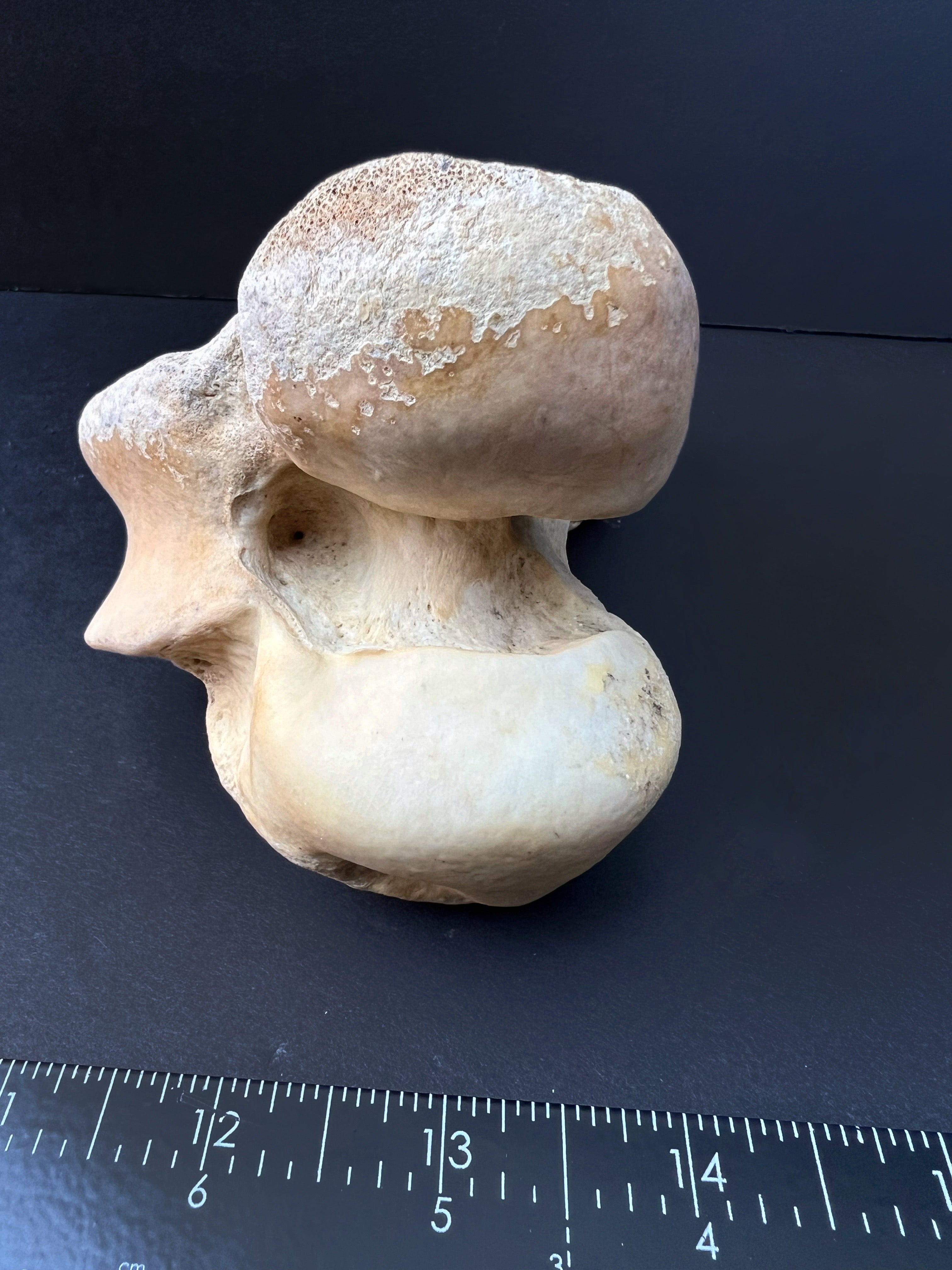 Distal Femur – Anatomical Joint Specimen