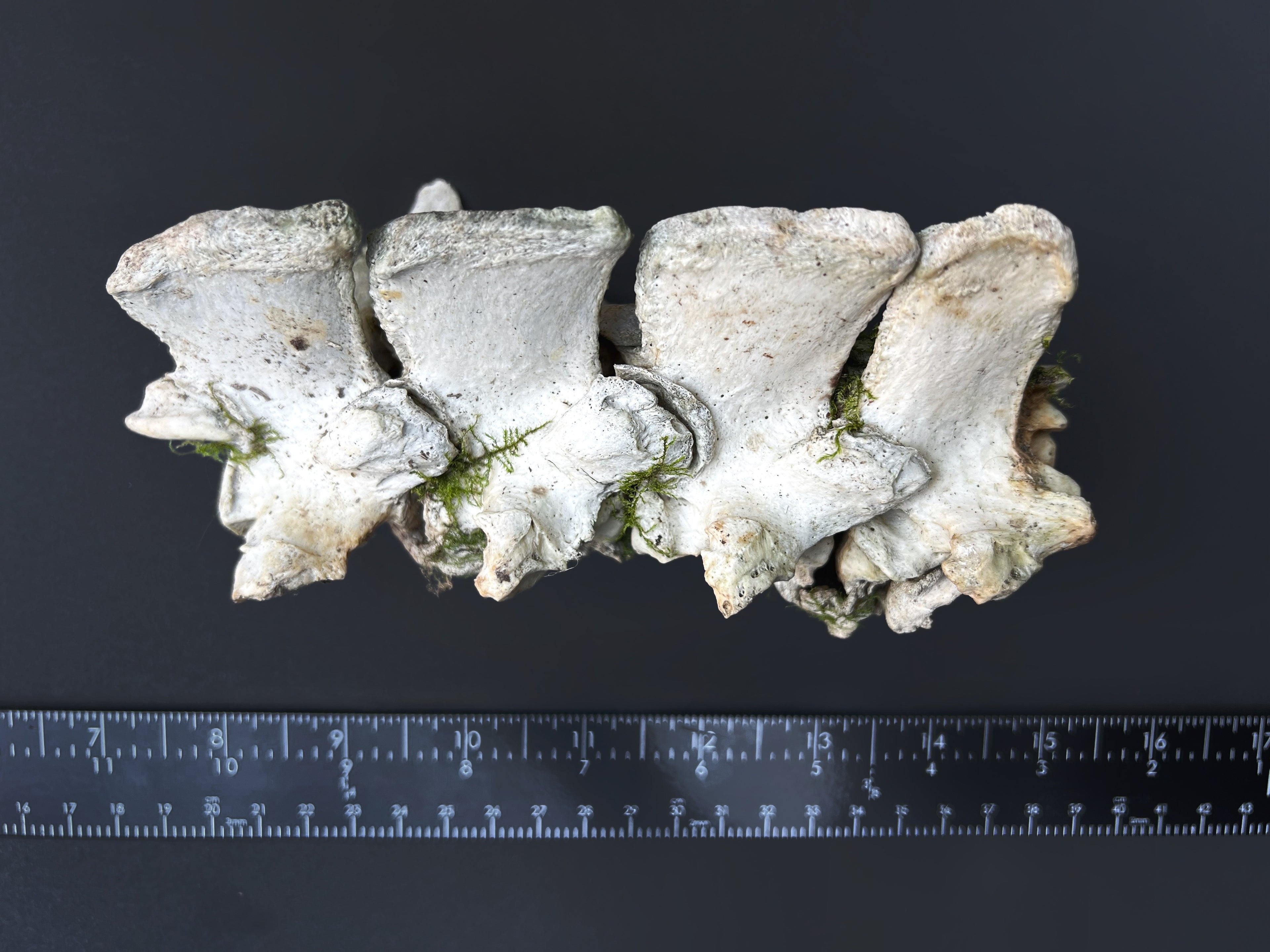 Arthritic Fusion of Spine - Natural Bone Specimen
