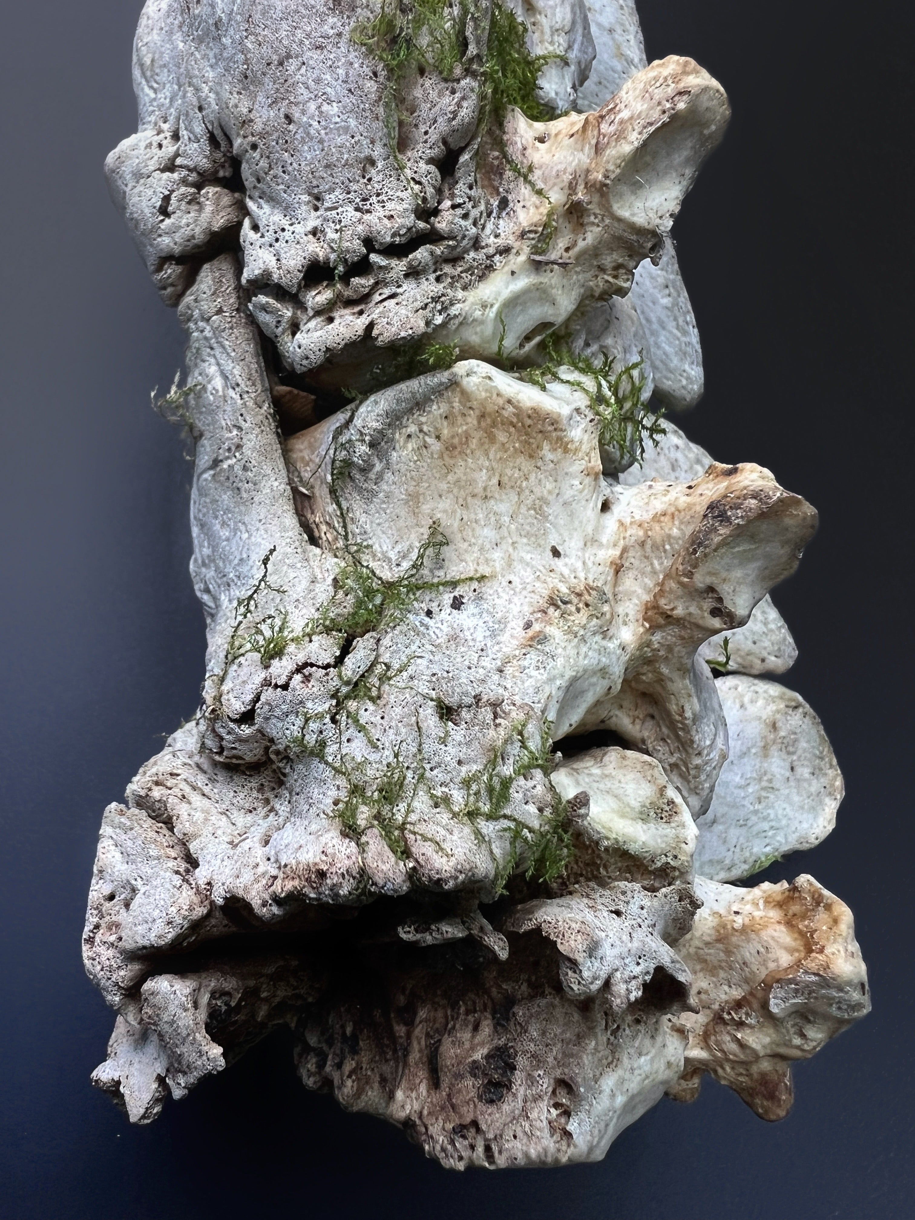 Arthritic Fusion of Spine - Natural Bone Specimen