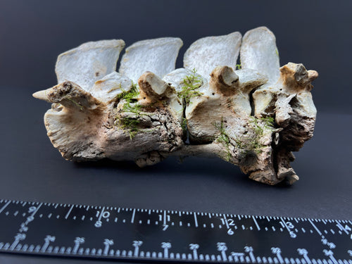 Arthritic Fusion of Spine - Natural Bone Specimen