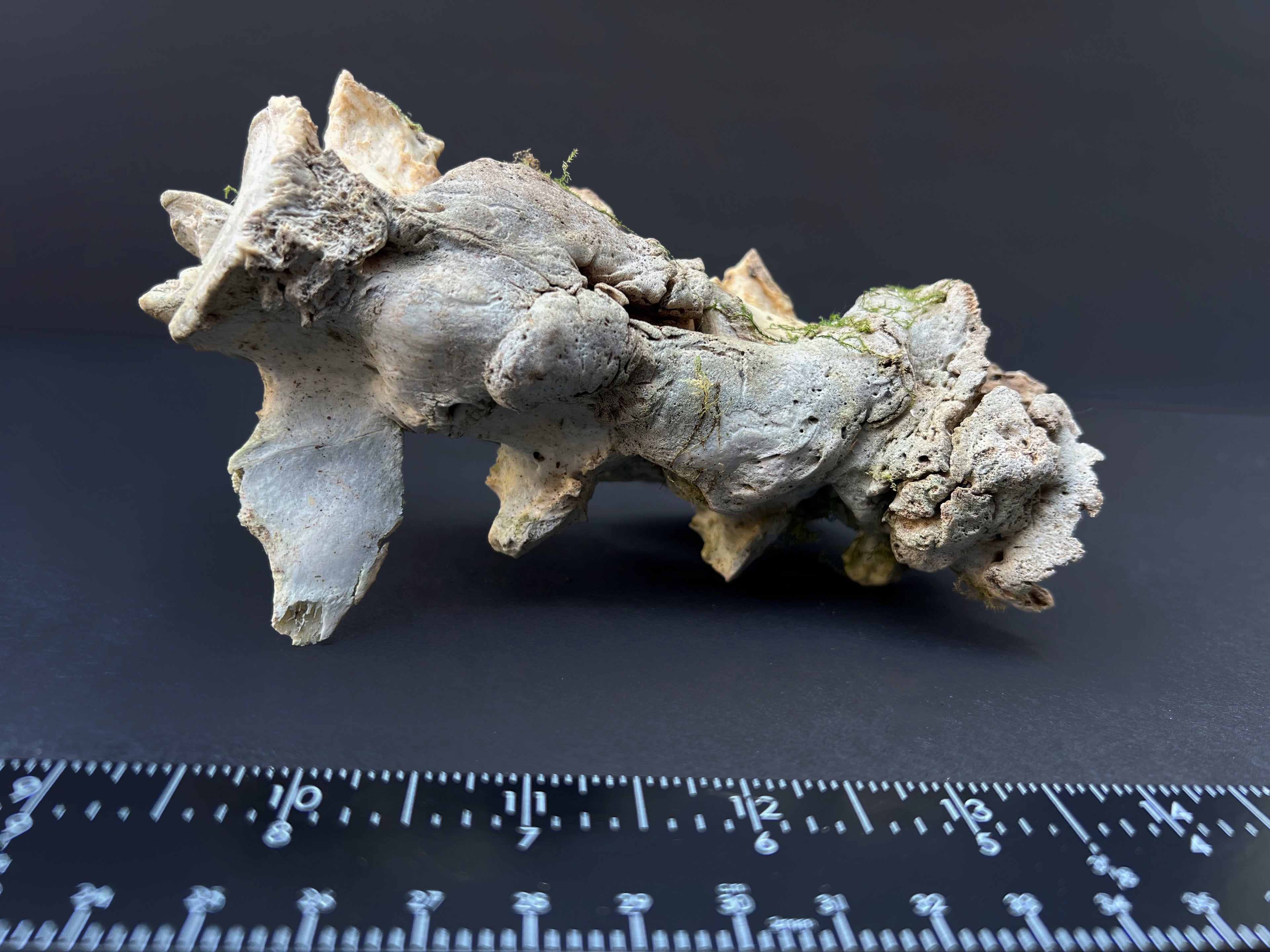 Arthritic Fusion of Spine - Natural Bone Specimen