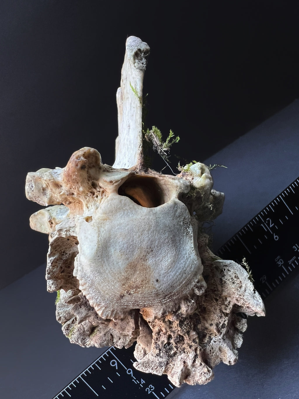 Arthritic Fusion of Spine - Natural Bone Specimen