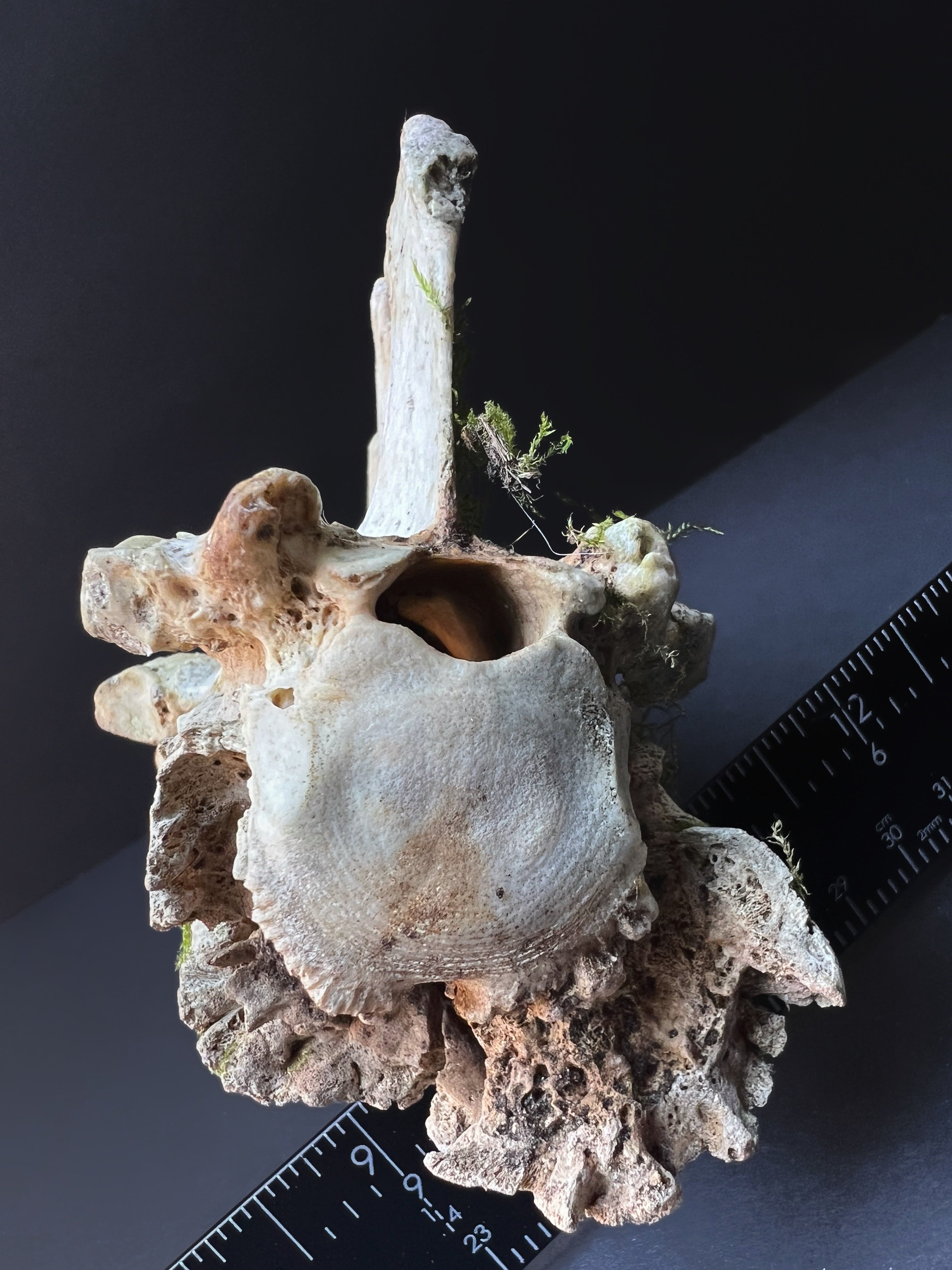 Arthritic Fusion of Spine - Natural Bone Specimen