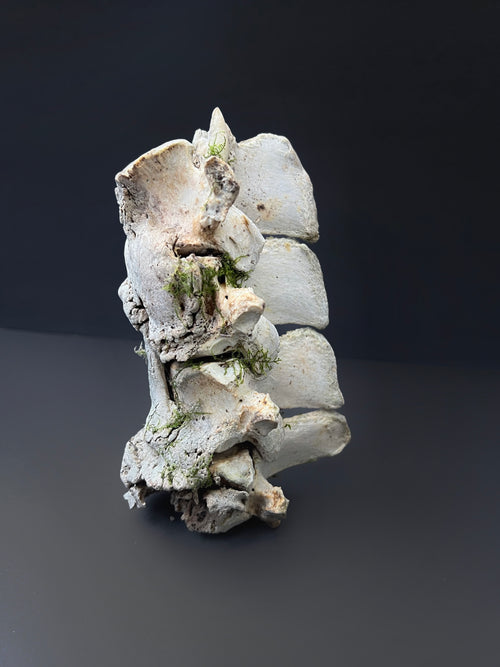 Arthritic Fusion of Spine - Natural Bone Specimen