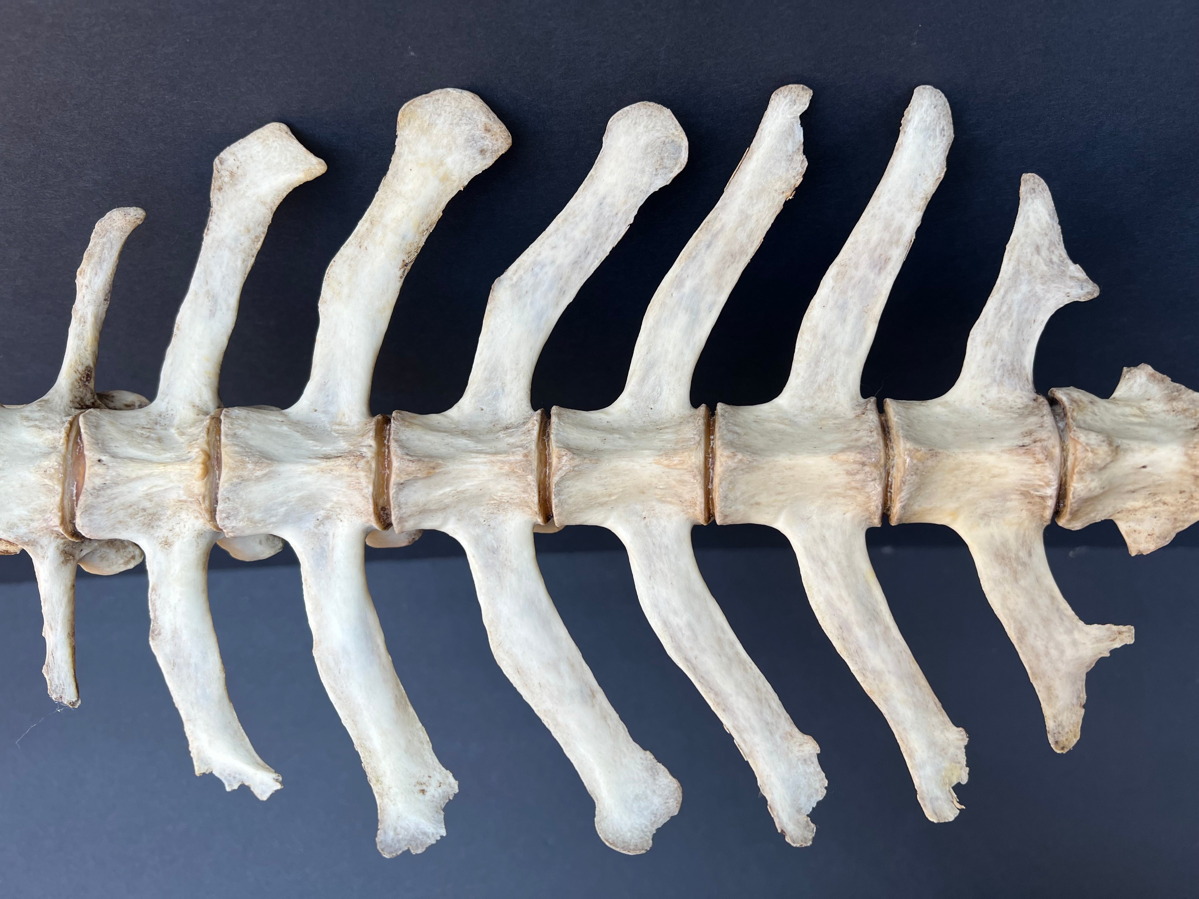Thoracic Vertebrae & Rib Section – Natural Bone Specimen