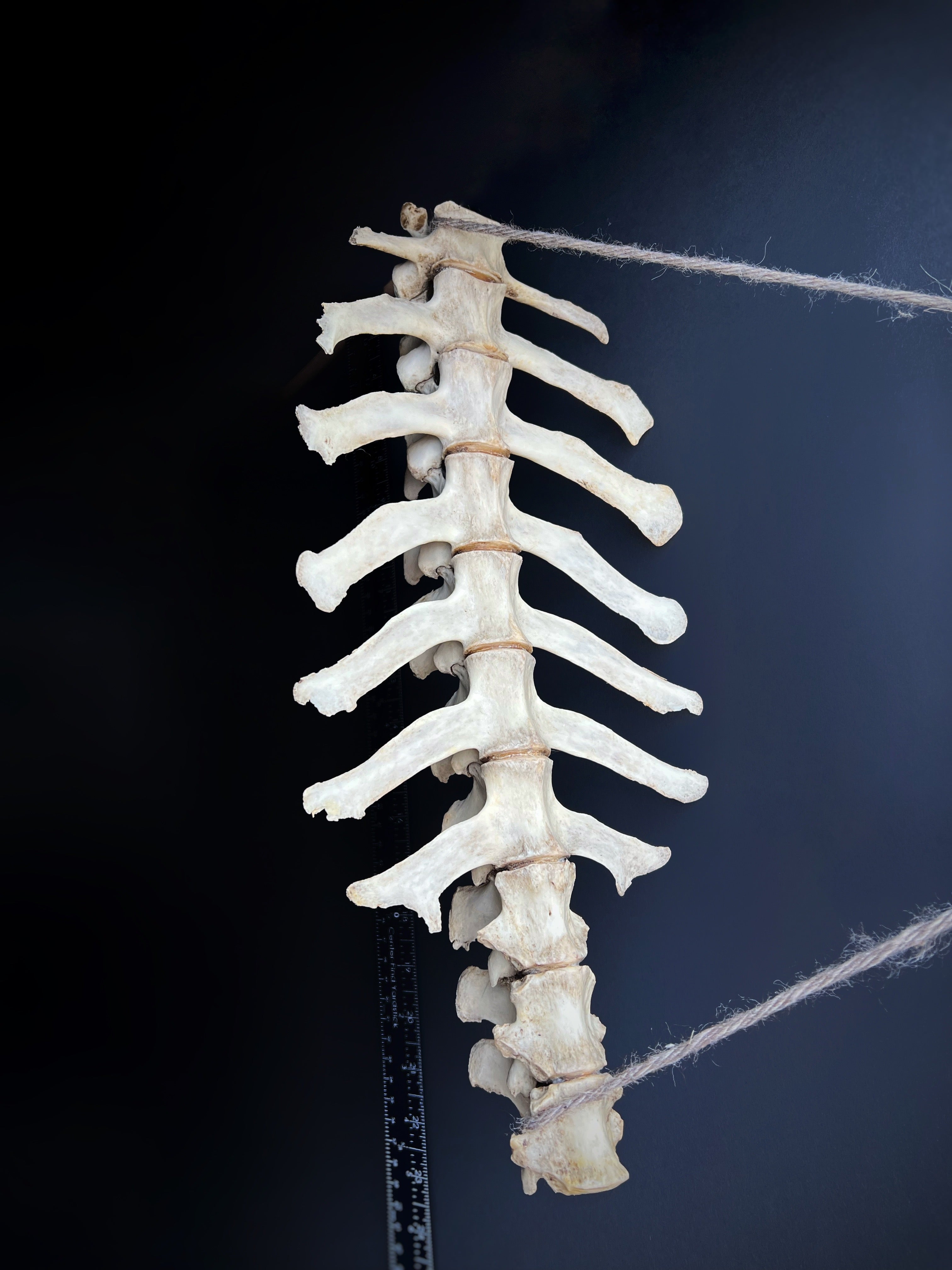 Thoracic Vertebrae & Rib Section – Natural Bone Specimen