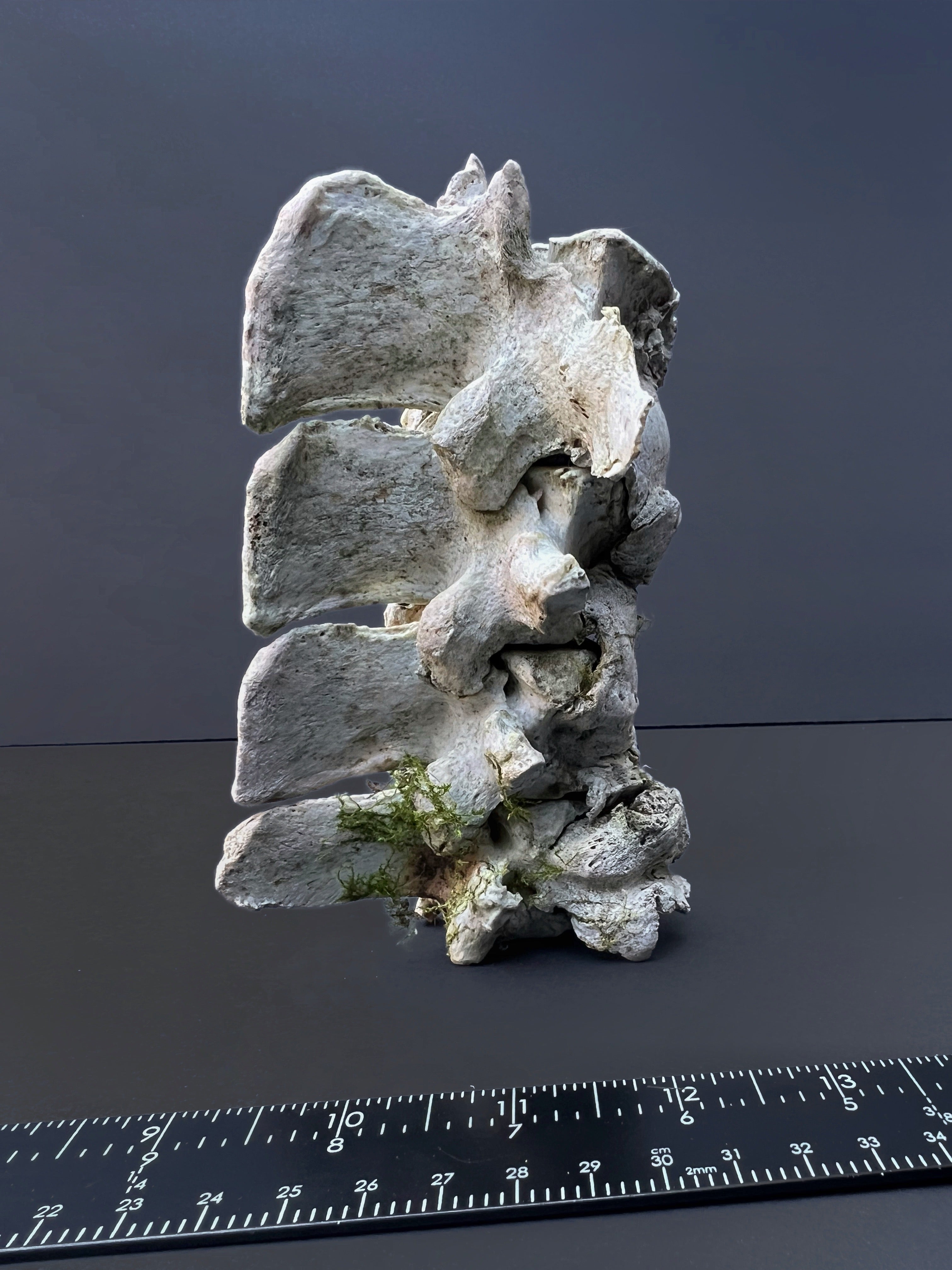 Arthritic Fusion of Spine - Natural Bone Specimen