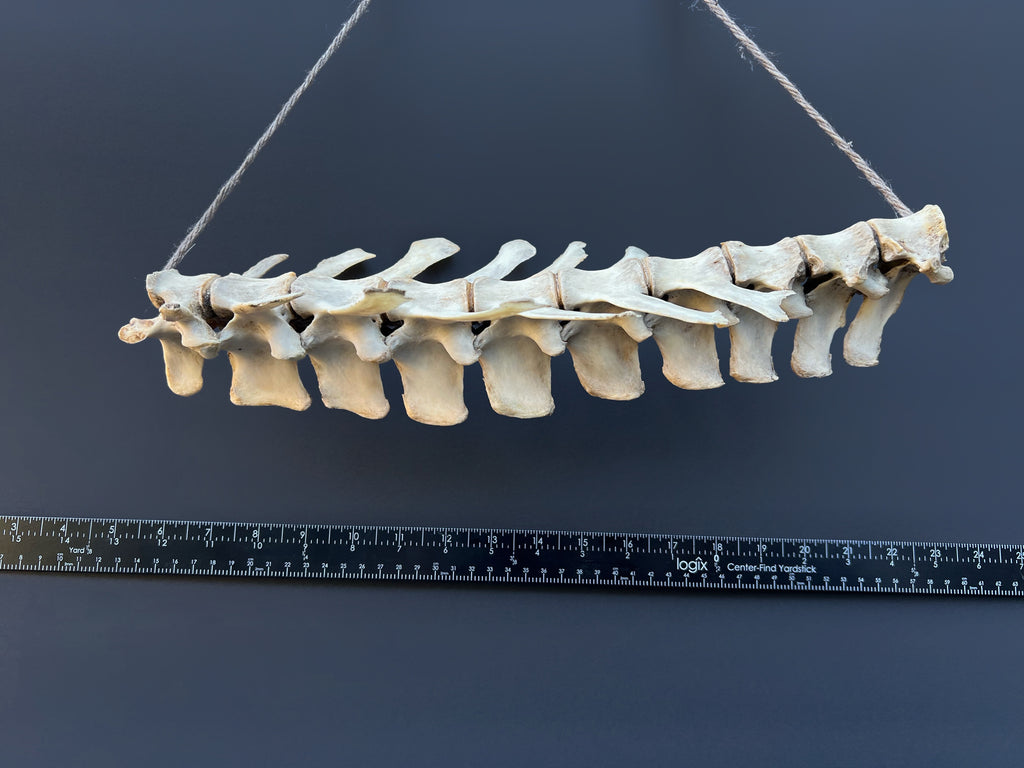 Thoracic Vertebrae & Rib Section – Natural Bone Specimen