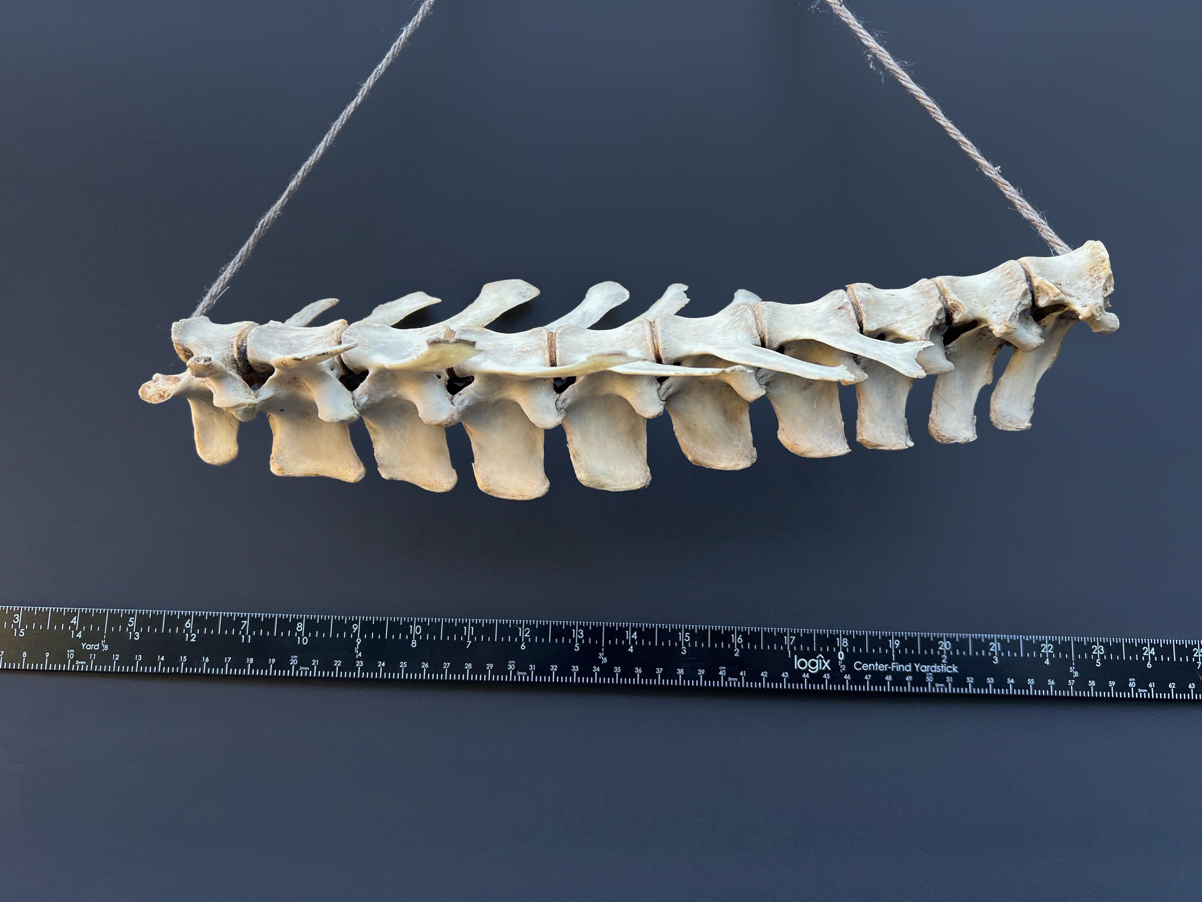Thoracic Vertebrae & Rib Section – Natural Bone Specimen