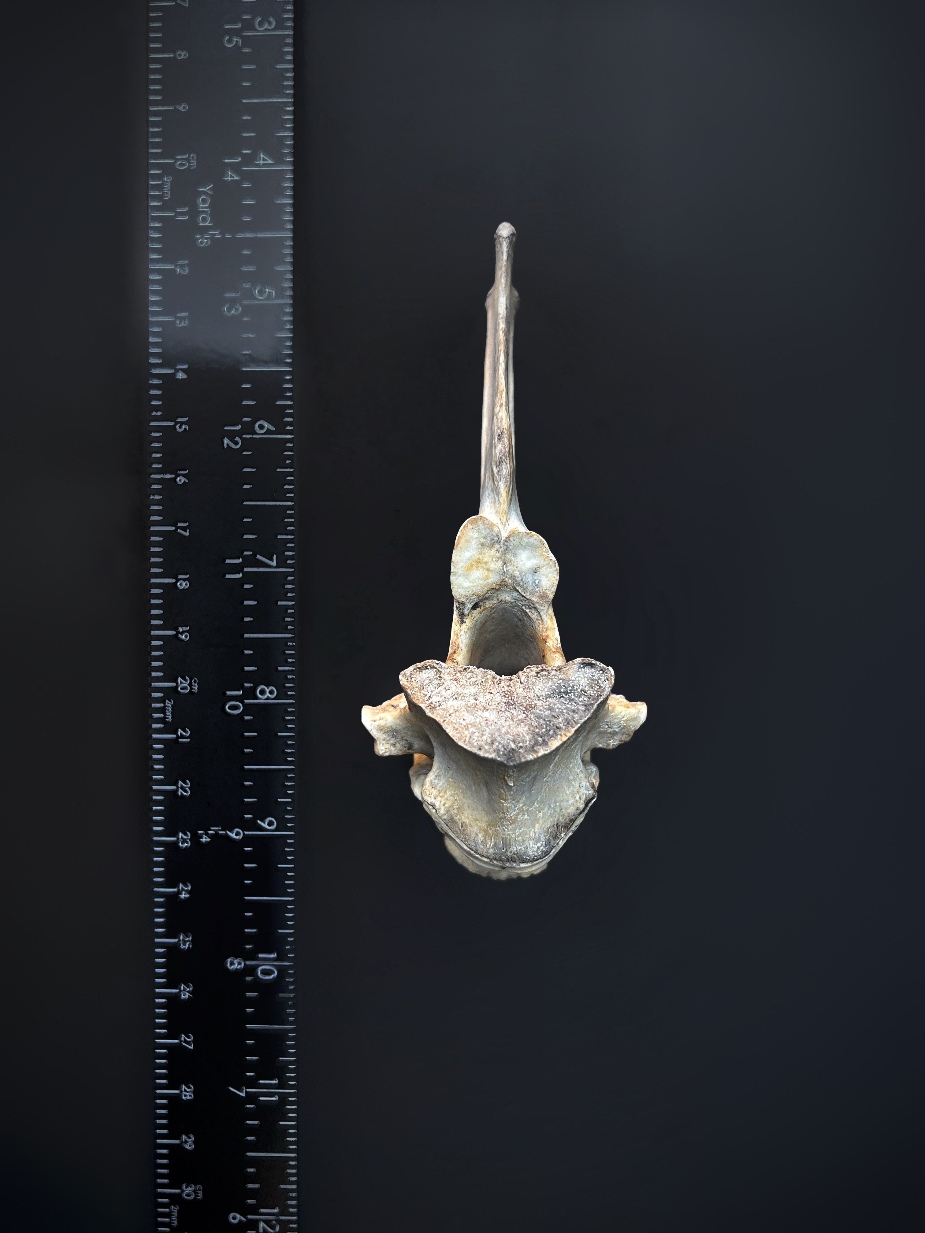 Fused Lumbar Vertebrae - Natural Bone Specimen
