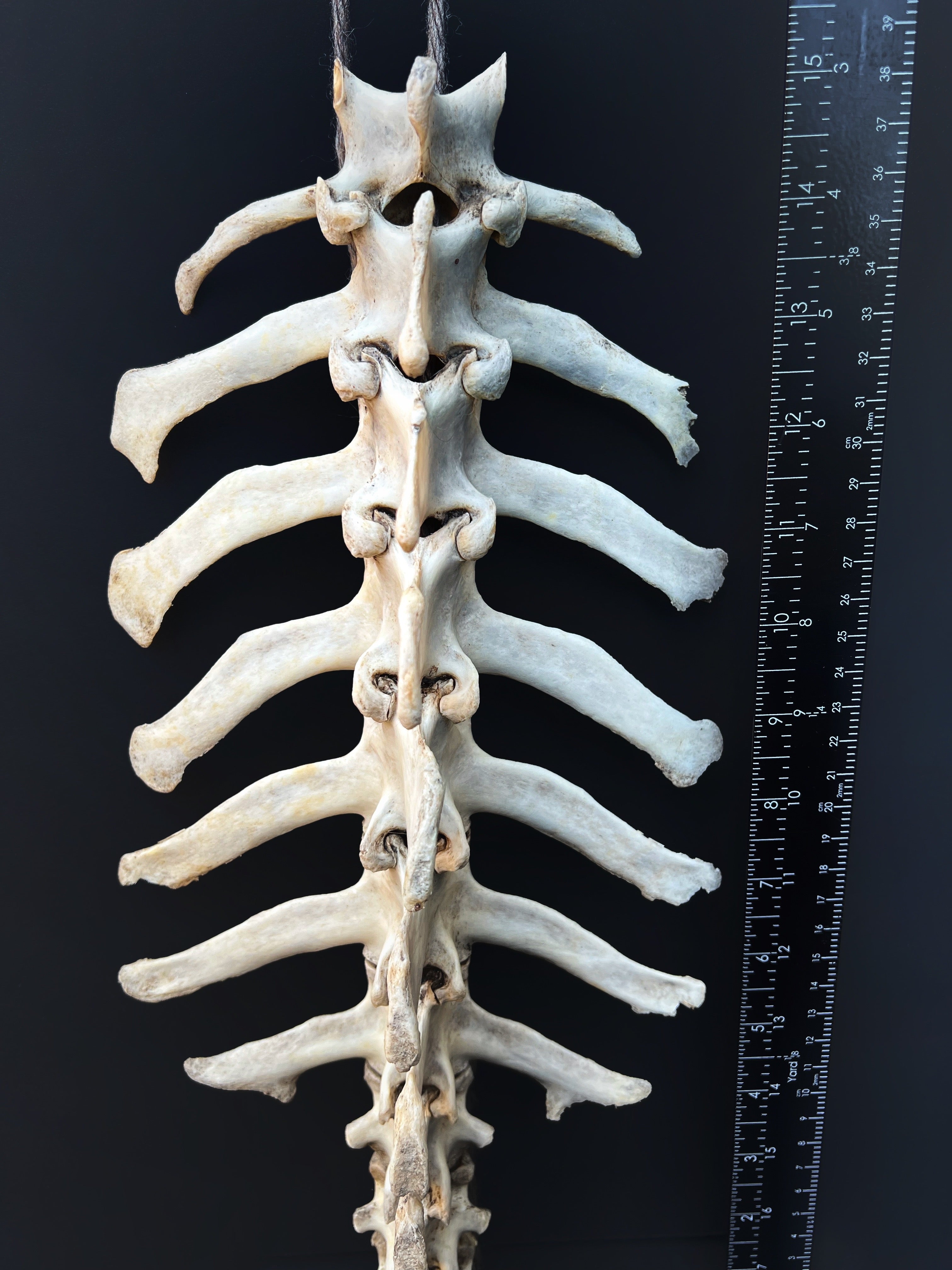 Thoracic Vertebrae & Rib Section – Natural Bone Specimen