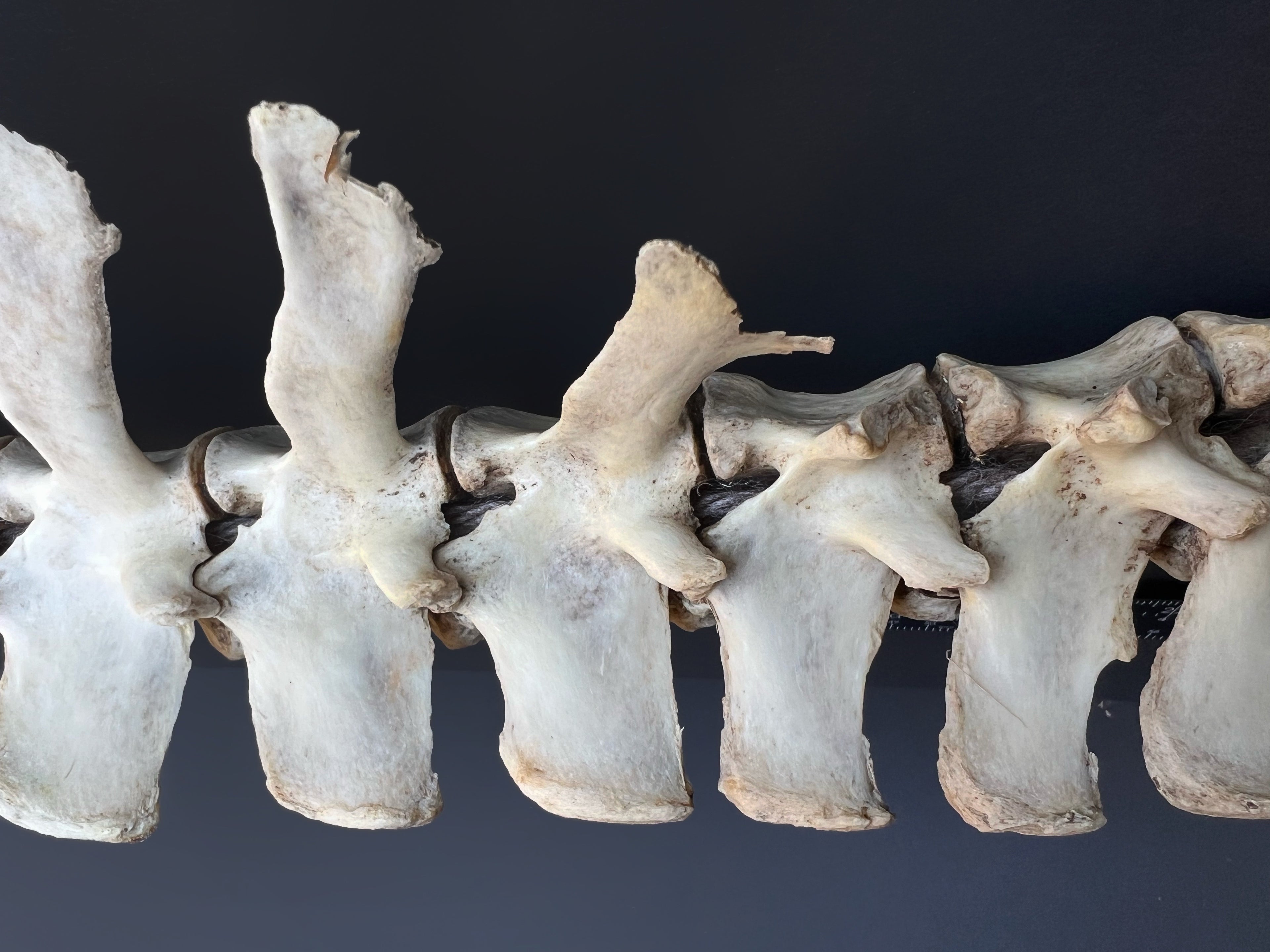 Thoracic Vertebrae & Rib Section – Natural Bone Specimen
