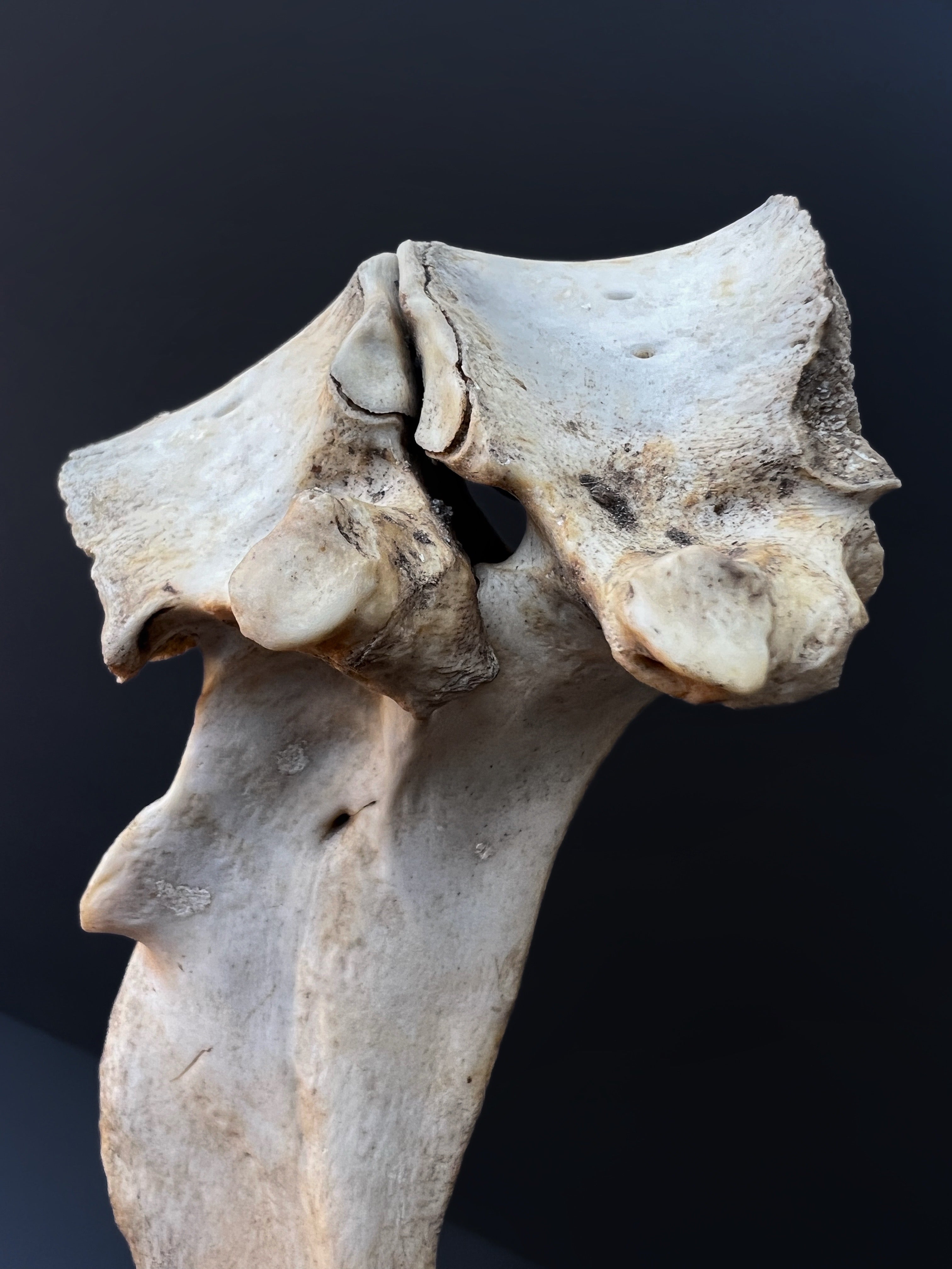 Fused Lumbar Vertebrae - Natural Bone Specimen