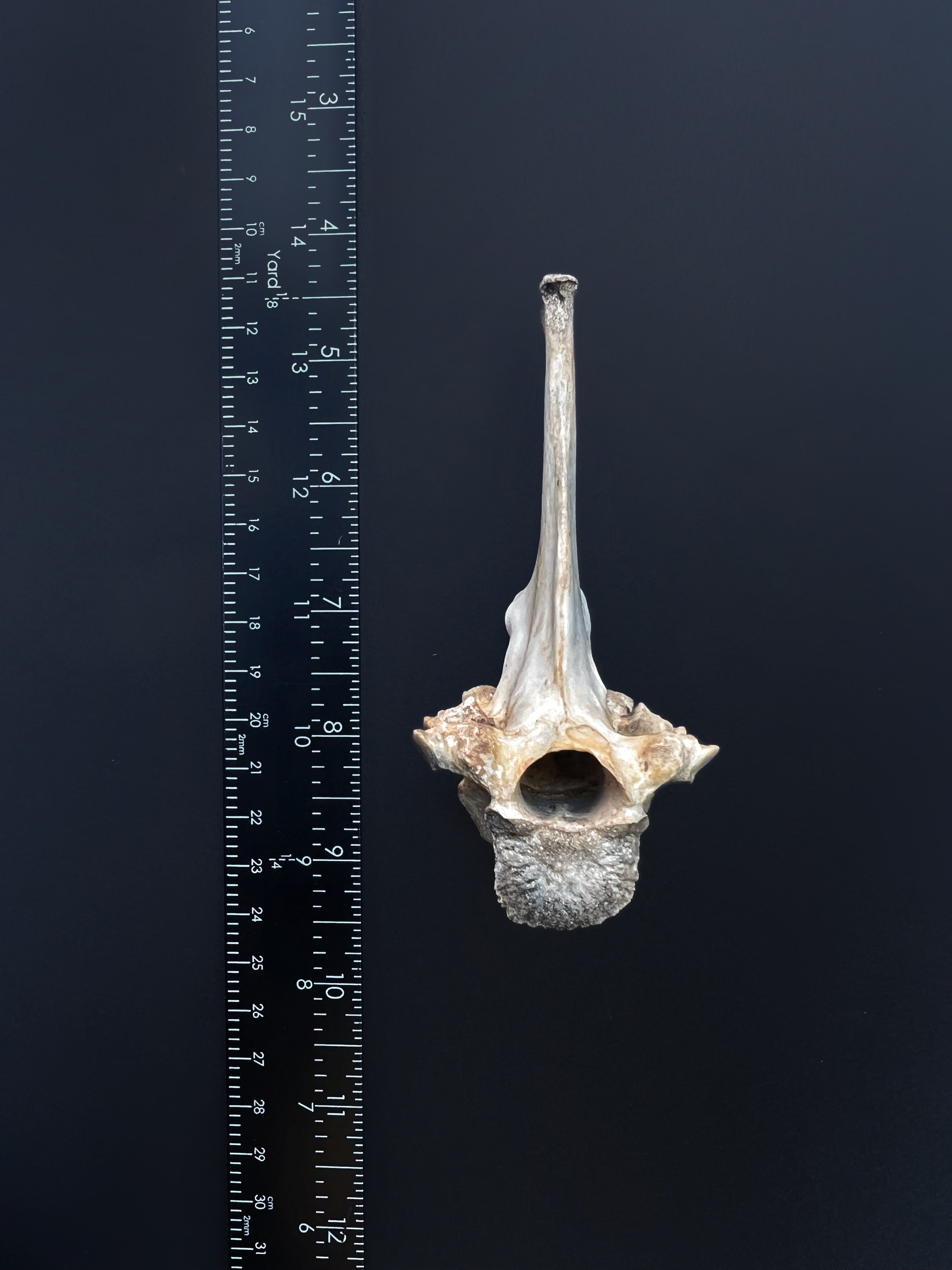 Fused Lumbar Vertebrae - Natural Bone Specimen